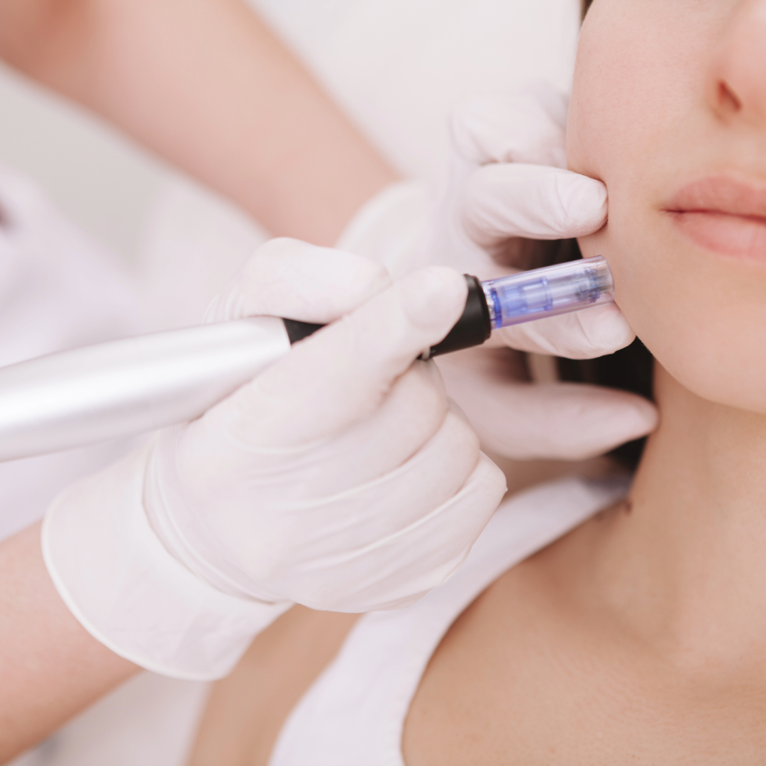 Microneedling Tools